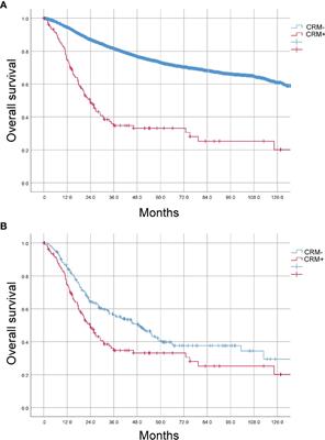 Incidence, predictors and prognostic implications of positive circumferential resection margin in colon cancer: A retrospective study in a Chinese high-volume cancer center